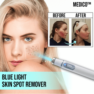 MEDICO™ Blue Light Skin Spot Remover
